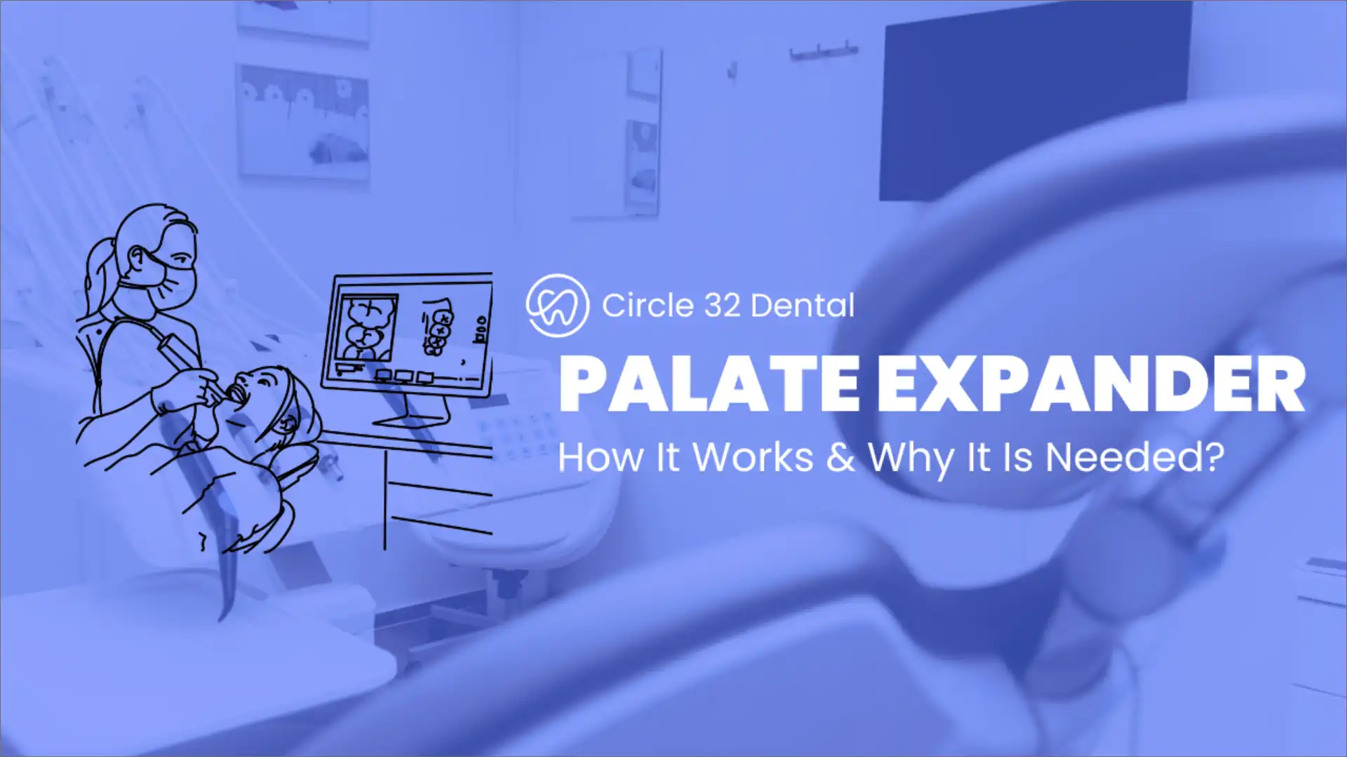 Palate Expander: What It Is, How It Works, and Why It Is Needed?