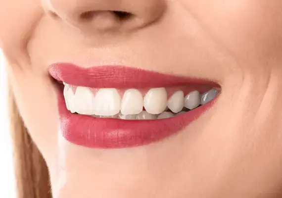 teeth-after-treatment