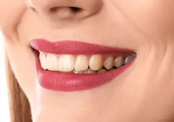 teeth-before-treatment